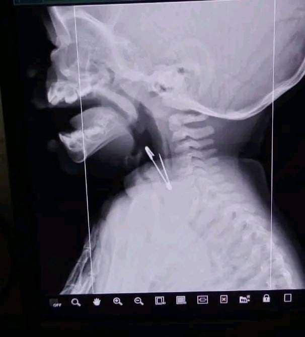 433001648 932828585512985 26060377522180361 n