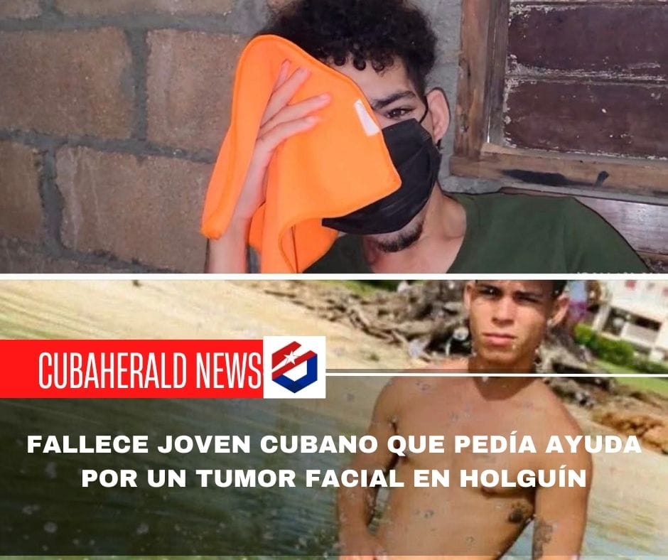 Fallece joven cubano que pedía ayuda por un tumor facial en Holguín