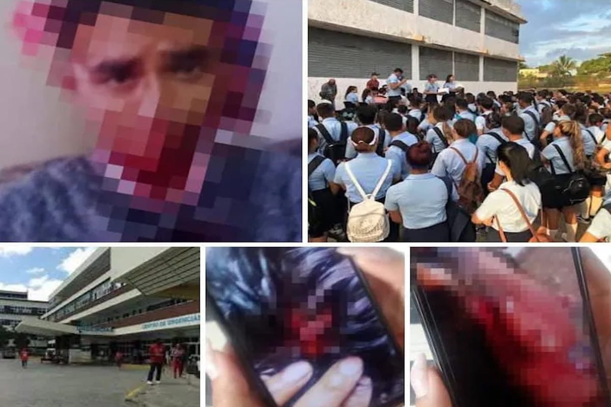 Asalto a estudiante de Preuniversitario en Guanabacoa deja lesiones graves
