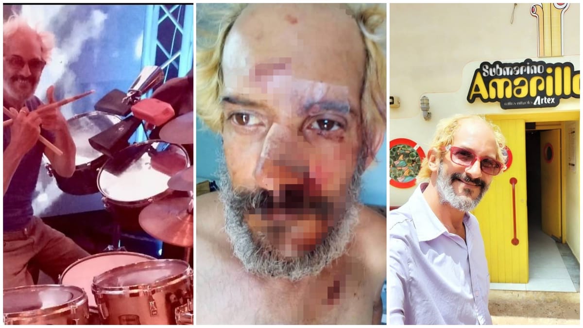 Reconocido baterista cubano Eduardo Longa es víctima de violento asalto en La Habana