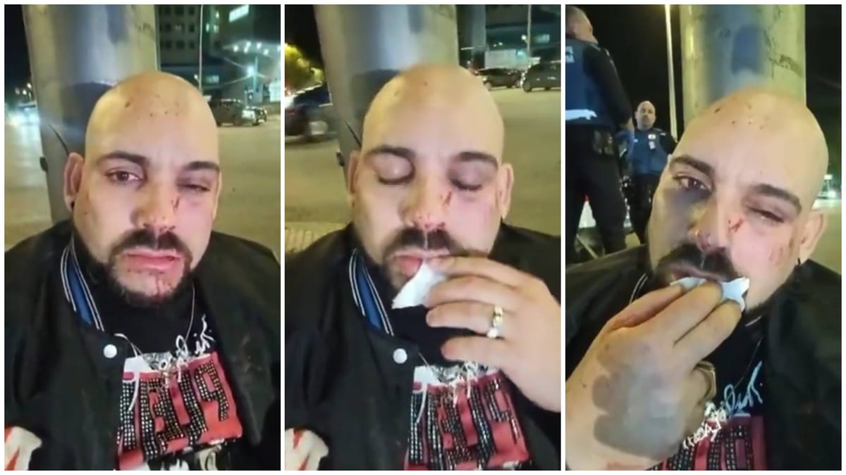 El activista cubano Lázaro Mireles denuncia brutal agresión en Madrid por su labor en defensa de los derechos humanos