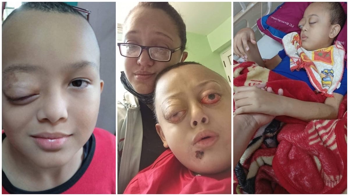 Damir, el niño cubano, recibe visa humanitaria para tratamiento en Estados Unidos