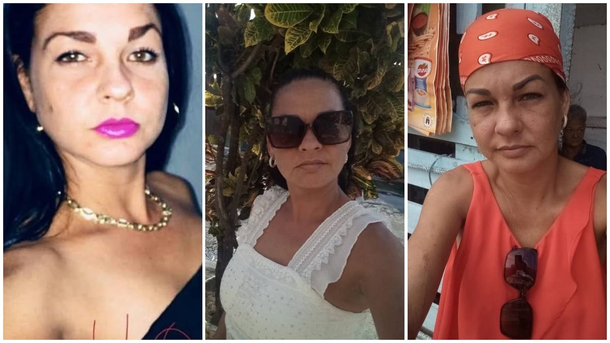 Mujer encontrada amarrada y gravemente herida en La Habana tras un presunto intento de asesinato