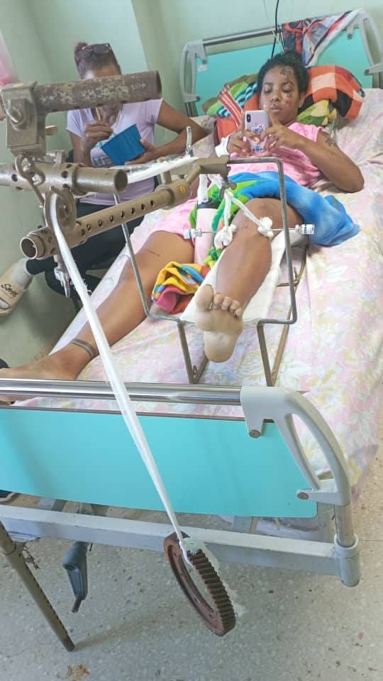 Familia cubana sigue esperando justicia y atención médica tras ser atropellada por patrulla policial en La Habana