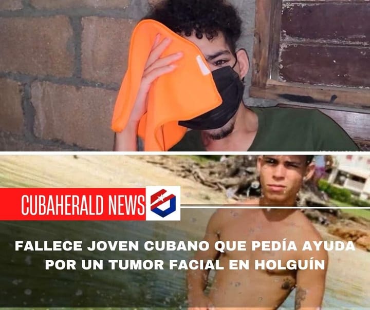 Fallece joven cubano que pedía ayuda por un tumor facial en Holguín