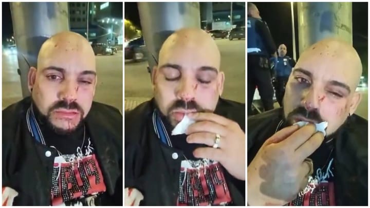 Hombre herido en la calle con policías cercanos.